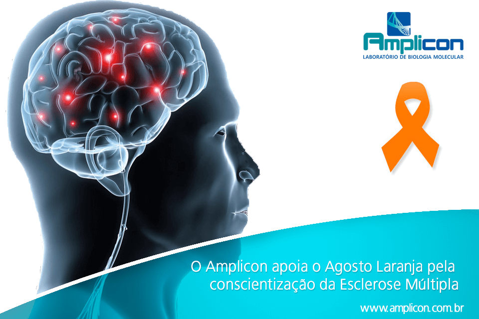 O laboratório Amplicon apoia o Agosto Laranja pela conscientização da Esclerose Múltipla 