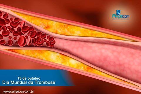 13 de outubro - Dia Mundial da Trombose 
